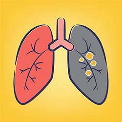 COPD Definition and Diagnosis